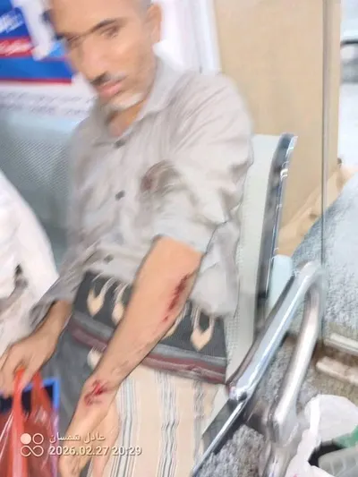 اخبار اليمن الان الحدث اليوم عاجل 