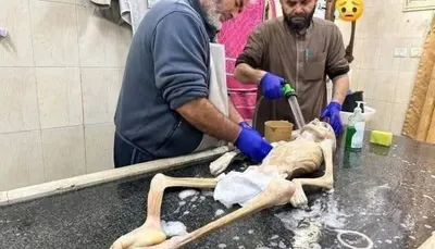 اخبار اليمن الان سياسي للتحرك لإنقاذ الجوعى والعطشى اخبار اليمن الان الحدث اليوم عاجل