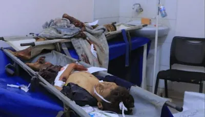 اخبار اليمن الان الحدث اليوم عاجل 