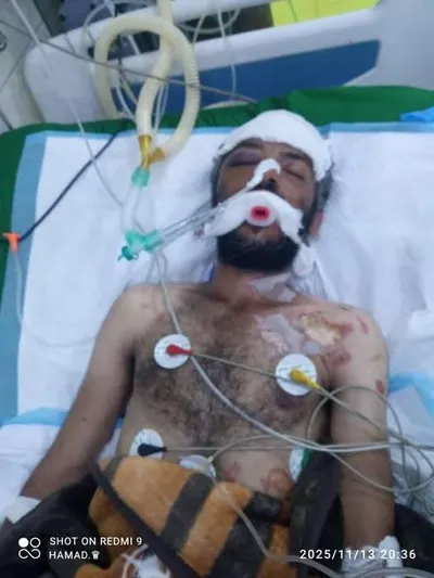 اخبار اليمن الان الحدث اليوم عاجل 