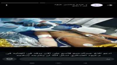 اخبار اليمن الان الحدث اليوم عاجل 