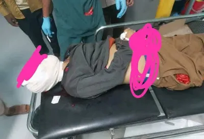 اخبار اليمن الان مقتل عسكري وأربعة مرافقيه الضالع اخبار اليمن الان الحدث اليوم عاجل