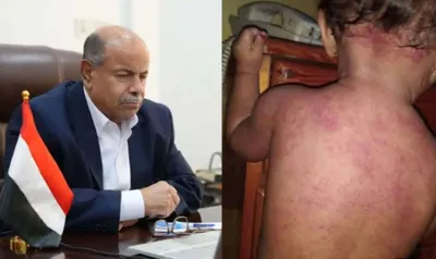 اخبار اليمن الان الكشف المسؤول البارز بازمة الكهرباء اخبار اليمن الان الحدث اليوم عاجل