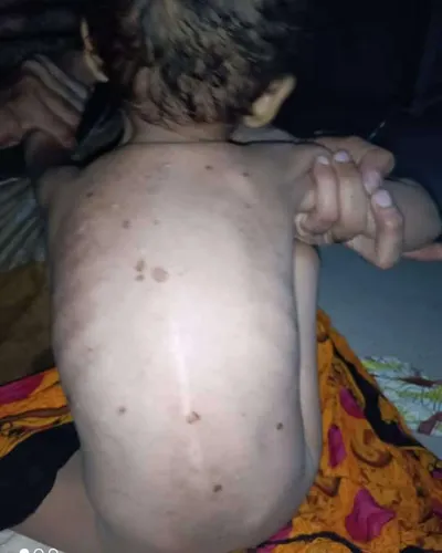 اخبار اليمن الان الحدث اليوم عاجل 