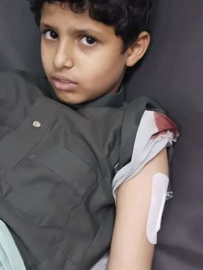 اخبار اليمن الان الحدث اليوم عاجل 