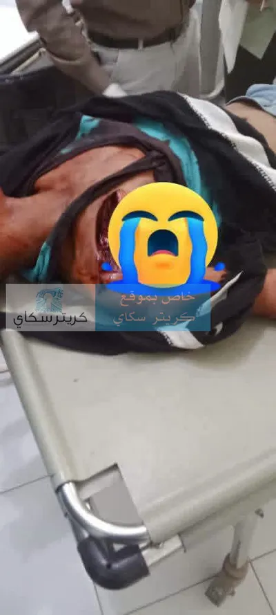 اخبار اليمن الان مقتل بطعنة القلب مشادة استراحة اخبار اليمن الان الحدث اليوم عاجل