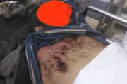 عرب تايم اخبار اليمن الان اخبار وتقارير برصاص قيادي اليمنية اخبار اليمن الان الحدث اليوم عاجل عرب تايم