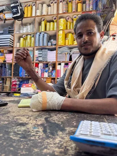 اخبار اليمن الان الناجين العرقوب لعلاجه بصنعاء والشركة اخبار اليمن الان الحدث اليوم عاجل