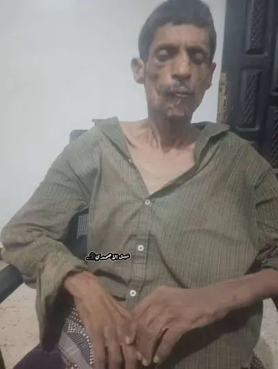 اخبار اليمن الان كابوتا بحالة متعبة وتنقله المستشفى اخبار اليمن الان الحدث اليوم عاجل