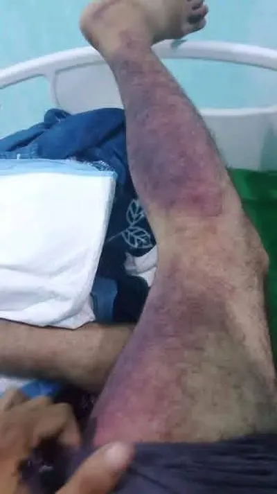 اخبار اليمن الان الحدث اليوم عاجل 