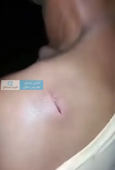 اخبار اليمن الان اتهامات لأفراد بالاعتداء واقتياده بالقوة اخبار اليمن الان الحدث اليوم عاجل