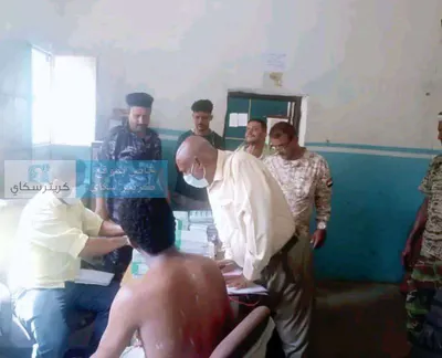 اخبار اليمن الان تفشي الماء والجرب السجون بكارثة اخبار اليمن الان الحدث اليوم عاجل