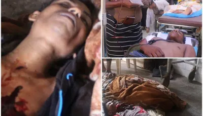 اخبار اليمن الان وإصابة صيادين برصاص البحرية الإرتيرية اخبار اليمن الان الحدث اليوم عاجل