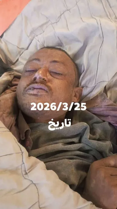 اخبار اليمن الان الحدث اليوم عاجل 