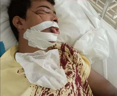 اخبار اليمن الان عسكري تابع لقوات العمالقة شوارع اخبار اليمن الان الحدث اليوم عاجل