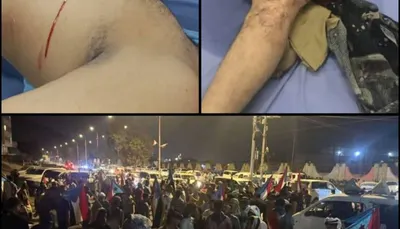 اخبار اليمن الان الحدث اليوم عاجل 