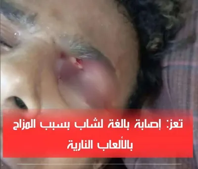 اخبار اليمن الان الحدث اليوم عاجل 