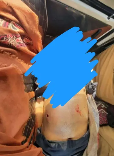 اخبار اليمن الان الحدث اليوم عاجل 