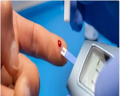 اخبار اليمن الان استشاري السكري السبب الرئيسي لفقدان اخبار اليمن الان الحدث اليوم عاجل