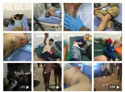 اخبار اليمن الان ارتفاع حصيلة التظاهرة السلمية معاشيق اخبار اليمن الان الحدث اليوم عاجل