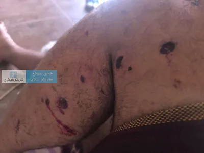 اخبار اليمن الان الحدث اليوم عاجل 