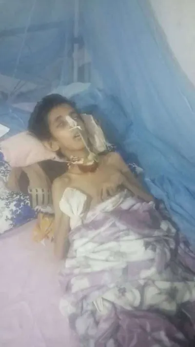 اخبار اليمن الان الحدث اليوم عاجل 