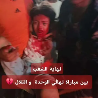 اخبار اليمن الان كلاسيكو الجماهير ومطالبات بمحاسبة المسؤولين اخبار اليمن الان الحدث اليوم عاجل