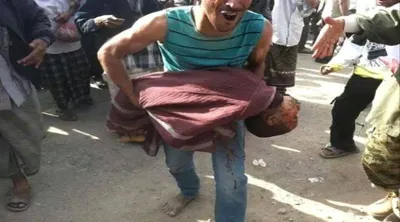 اخبار اليمن الان الحدث اليوم عاجل 