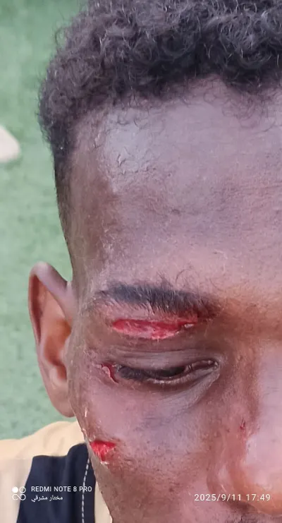 اخبار اليمن الان الحدث اليوم عاجل 