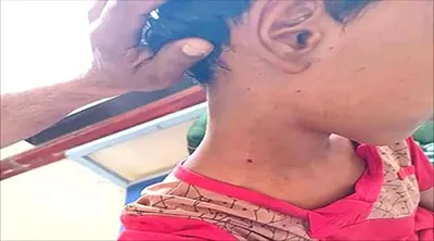 اخبار اليمن الان رصاص قناص حوثي يصيب القبيطة اخبار اليمن الان الحدث اليوم عاجل