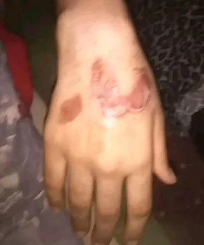 اخبار اليمن الان شعرها وحواجبها ـرقها بطريقة المحافظة اخبار اليمن الان الحدث اليوم عاجل