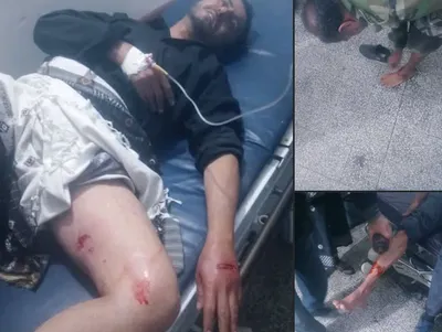 اخبار اليمن الان كلاب مسعورة تهاجم المواطنين اخبار اليمن الان الحدث اليوم عاجل