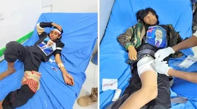 اخبار اليمن الان الحدث اليوم عاجل 