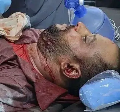 اخبار اليمن الان الحدث اليوم عاجل 