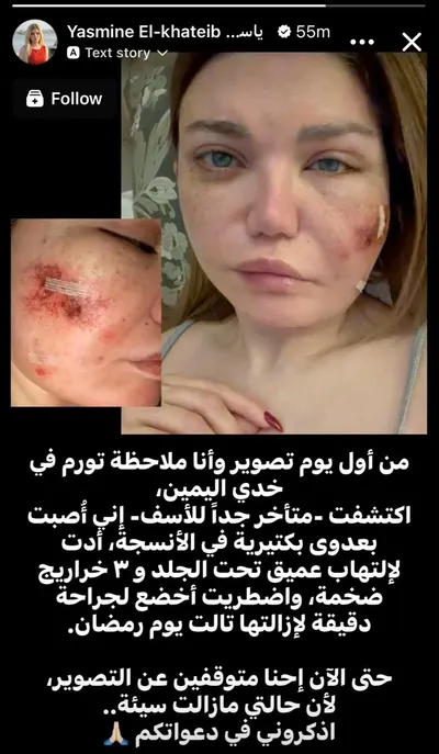 اخبار اليمن الان ياسمين الخطيب جمهورها خضوعها لعملية اخبار اليمن الان الحدث اليوم عاجل