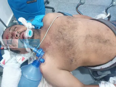 اخبار اليمن الان بطاقة هاتف مجهول غيبوبة مروري اخبار اليمن الان الحدث اليوم عاجل