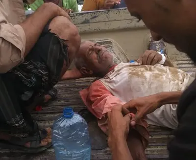 اخبار اليمن الان الحدث اليوم عاجل 