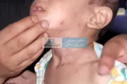 اخبار اليمن الان الحدث اليوم عاجل كريتر إسكاي