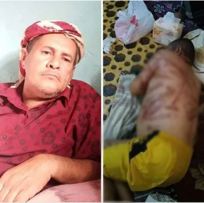 اخبار اليمن الان الحدث اليوم عاجل 