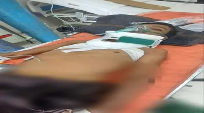 اخبار اليمن الان إصابة خطيرة لطفل برصاص قناص اخبار اليمن الان الحدث اليوم عاجل