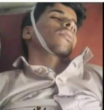 اخبار اليمن الان مق مواطن استدعائه لإدارة الامن اخبار اليمن الان الحدث اليوم عاجل