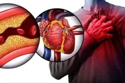 عدن تايم اخبار اليمن الان أسباب ارتفاع الكوليسترول الوقاية والعلاج اخبار اليمن الان الحدث اليوم عاجل عدن تايم