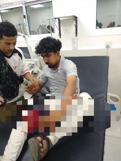 اخبار اليمن الان الصور للجرحى المتظاهرين المصابين معاشيق اخبار اليمن الان الحدث اليوم عاجل