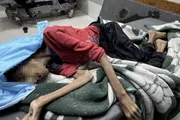 وكالة الصحافة اليمنية اخبار اليمن الان المجاعة تتفاقم انخفاض وزنها للنصف اخبار اليمن الان الحدث اليوم عاجل وكالة الصحافة اليمنية
