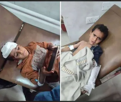 اخبار اليمن الان الحدث اليوم عاجل 