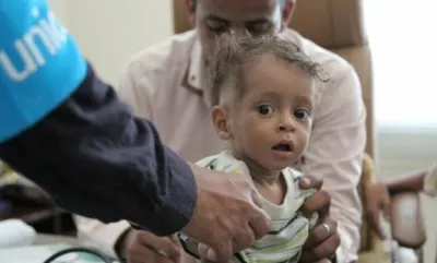 اخبار اليمن الان الحدث اليوم عاجل 