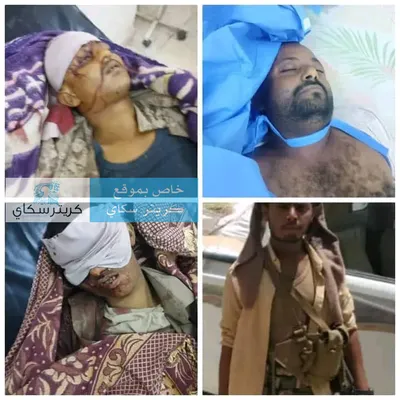 اخبار اليمن الان ضحايا اللواء الرابع الوطن حضرموت اخبار اليمن الان الحدث اليوم عاجل