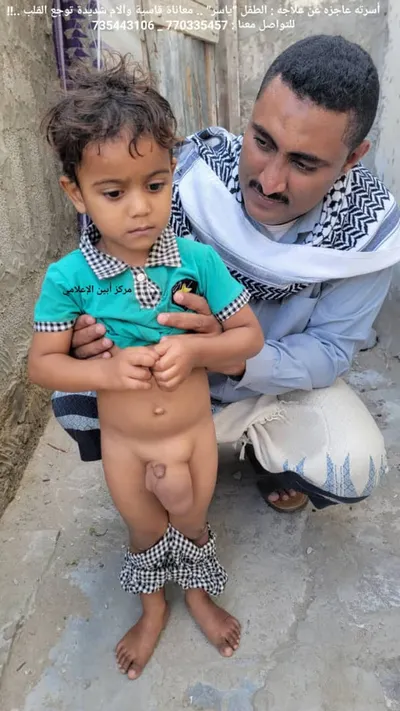 اخبار اليمن الان مناشدات عاجلة لإنقاذ يعاني مؤلمة اخبار اليمن الان الحدث اليوم عاجل