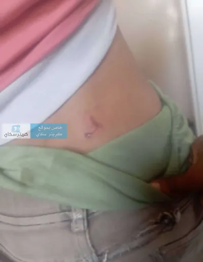 اخبار اليمن الان إصابة بإصابته بالسعار التربة ومطالبات اخبار اليمن الان الحدث اليوم عاجل