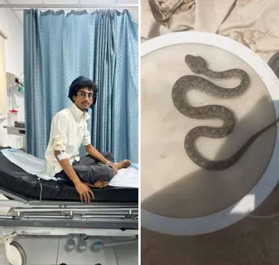 اخبار اليمن الان نجاة شاب لدغة أفعى اخبار اليمن الان الحدث اليوم عاجل